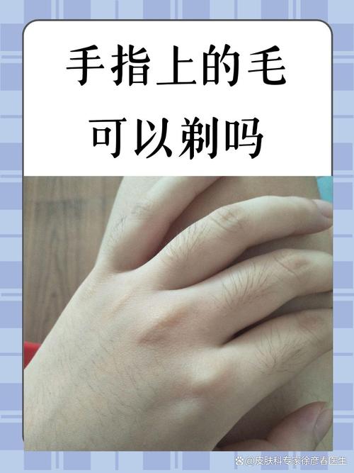 手指长毛预示着什么命运？