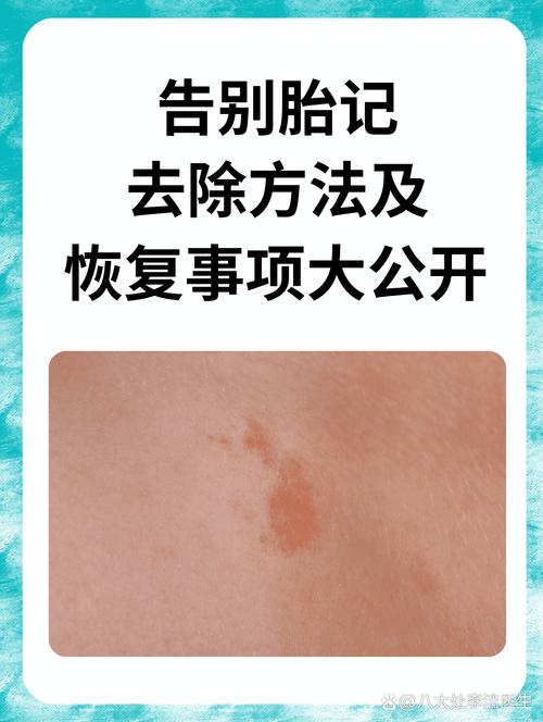 凤凰胎记是什么命？腰上胎记如何改写命运？