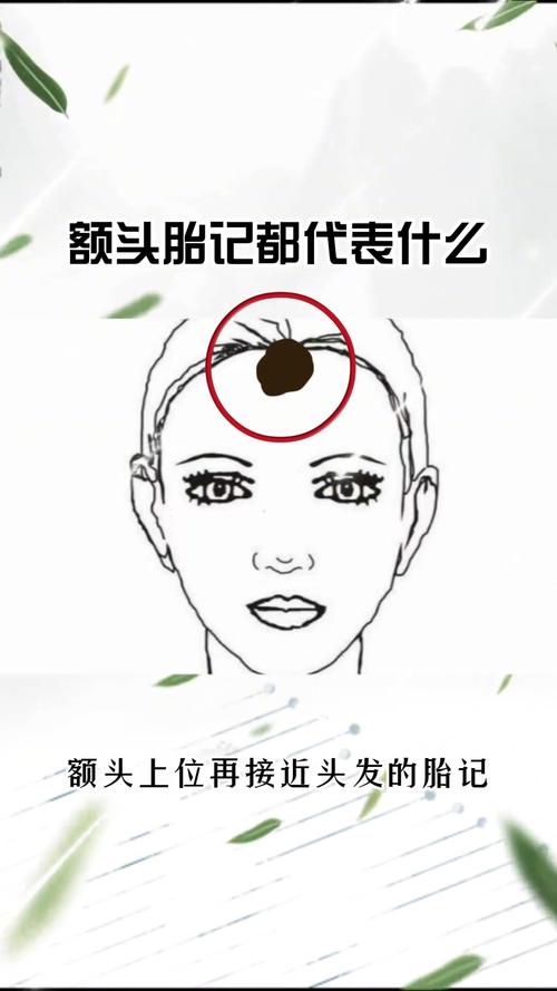 额头胎记位置是否影响命运？