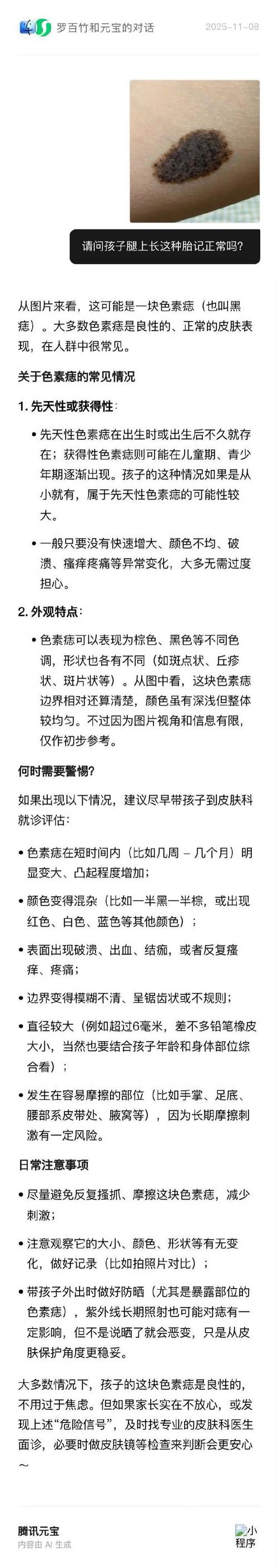 大腿根部胎记影响命运吗？如何改善腿部胎记？
