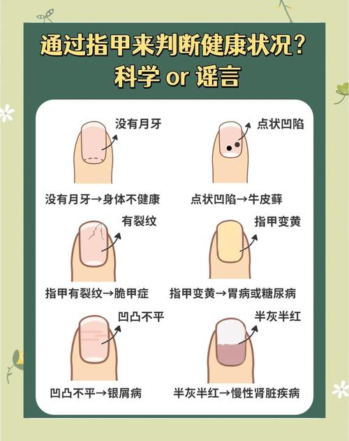 指甲盖小女生命好吗，这样的命运是否吉利？