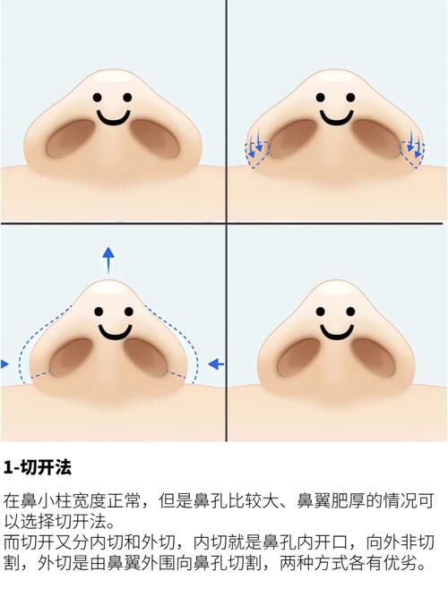 只缩鼻翼对风水有何具体影响？