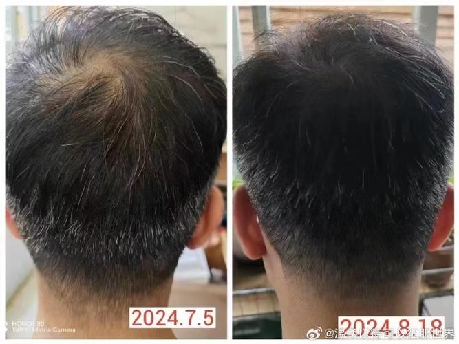 头发黑白变化对家居风水有何具体影响？