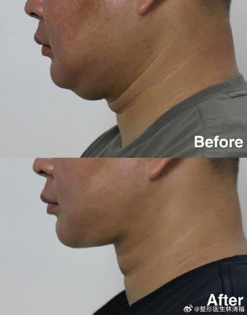 男士脖子短是天生的吗？这会影响命运吗？