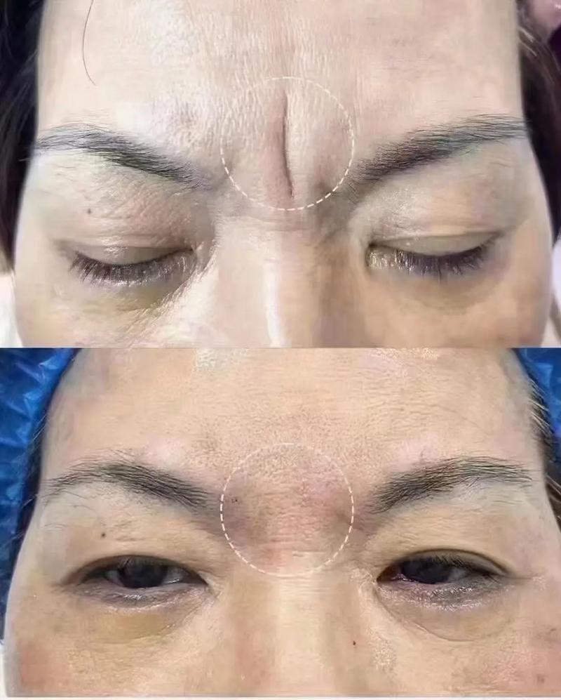 脸上皱纹对家居风水有影响吗？